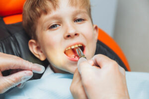 Why Would My Child Need a Tooth Extraction?
